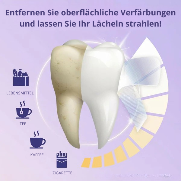 BLEACHING-STRIPS – PAP+ OHNE PEROXID - SmileLAB