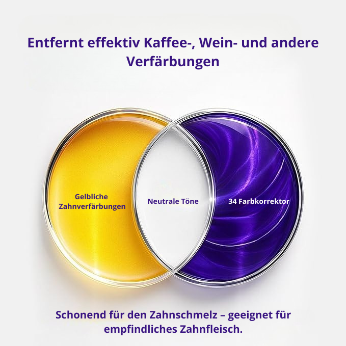 BLEACHING-STRIPS – PAP+ OHNE PEROXID - SmileLAB